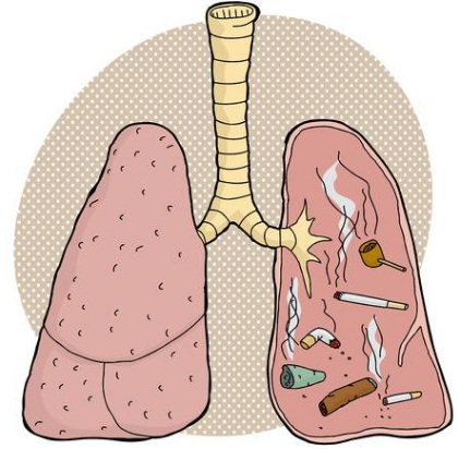 Phổi dễ bị nhiễm độc bởi một hoặc nhiều tác nhân từ môi trường