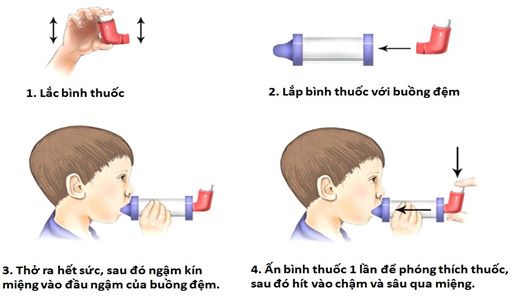 Cách dùng bình hít định liều và buồng đệm.