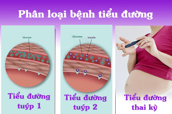 Phân loại bệnh tiểu đường như thế nào?