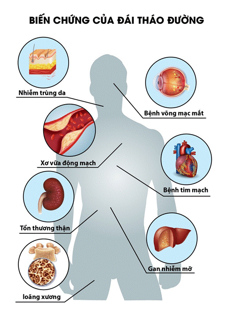 Biến chứng bệnh tiểu đường giai đoạn cuối