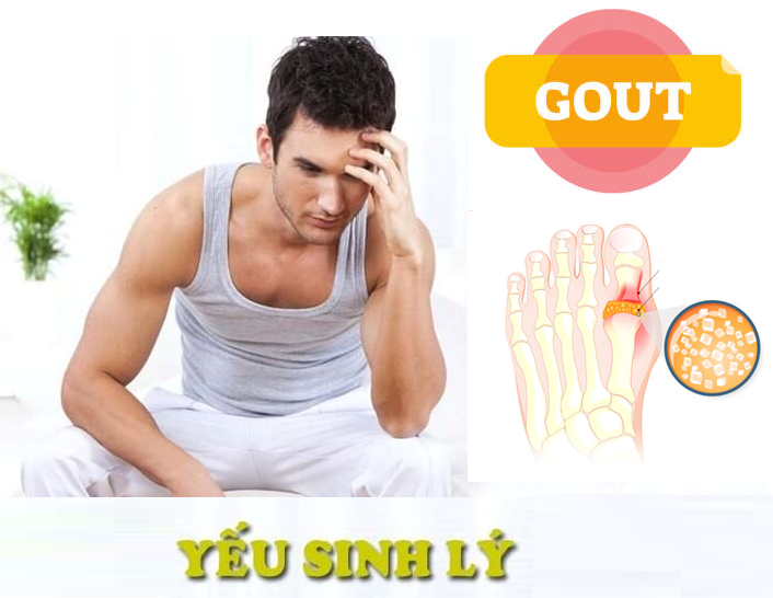 Cảnh báo: Bạn có thể bị yếu sinh lý vì bệnh gút!