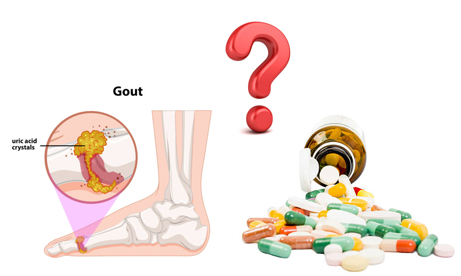 Bệnh gút uống thuốc gì? Hướng đi hiệu quả nhất dành cho người bệnh!