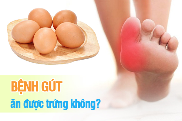 Bệnh gút ăn được trứng không?