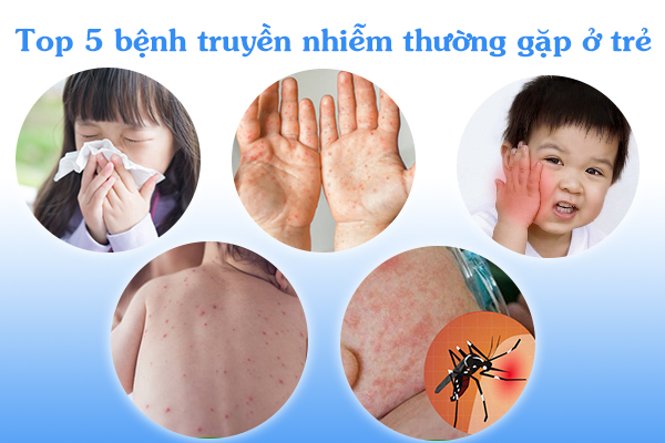 Top 5 bệnh truyền nhiễm thường gặp ở trẻ