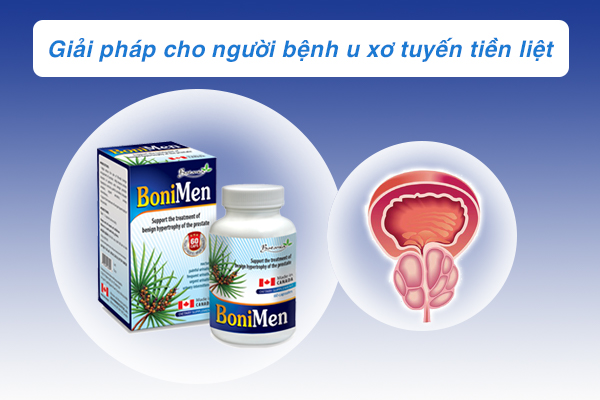 BoniMen- Giải pháp hiệu quả cho người bệnh u xơ tuyến tiền liệt