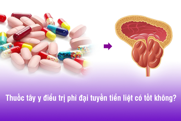 Thuốc tây y điều trị phì đại tuyến tiền liệt có tốt không?