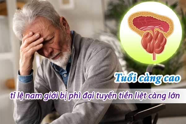 Tuổi càng cao, tỉ lệ nam giới bị phì đại tuyến tiền liệt càng lớn