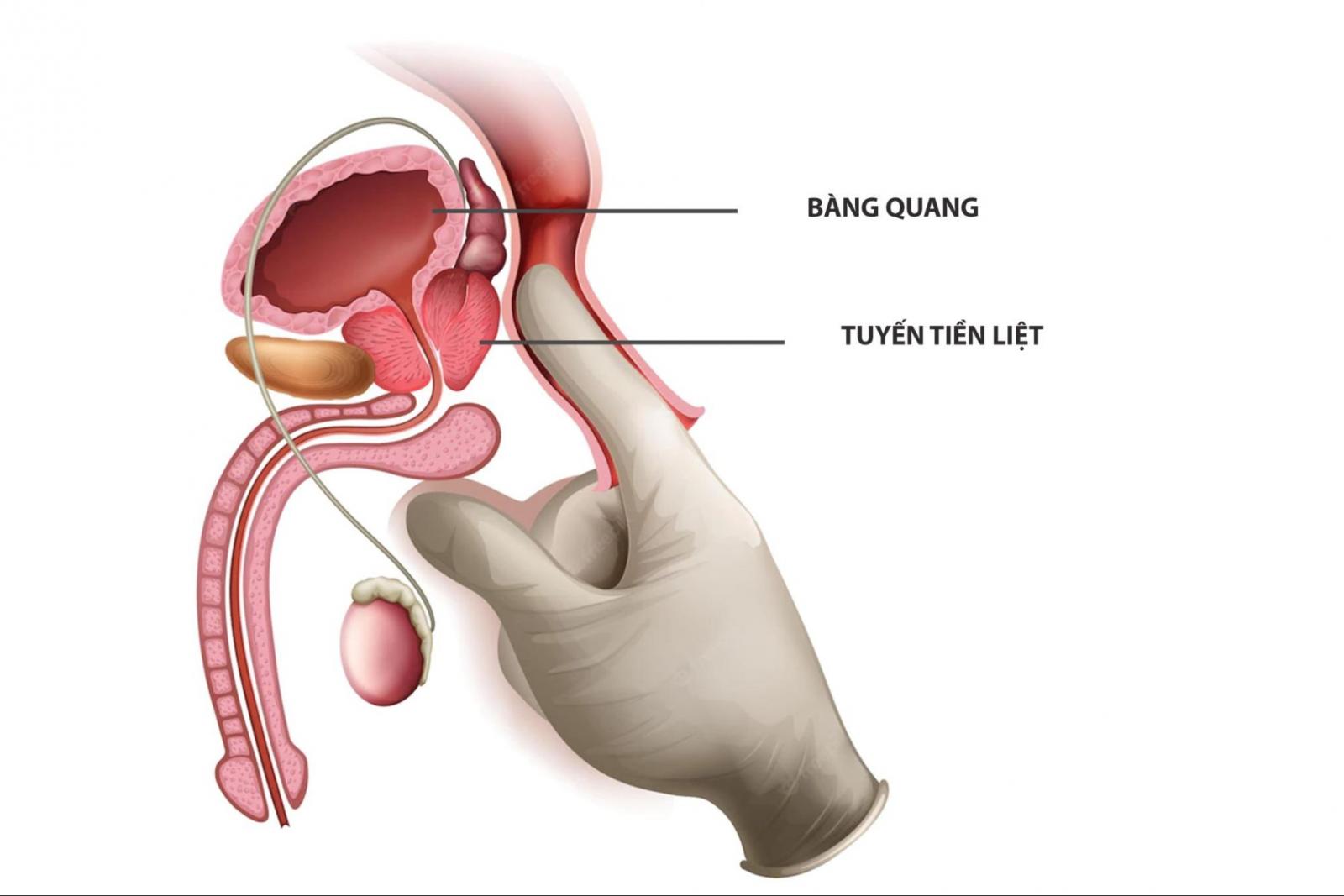 Thăm khám trực tràng