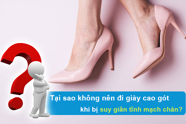 Tại sao không nên đi giày cao gót khi bị suy giãn tĩnh mạch chân?