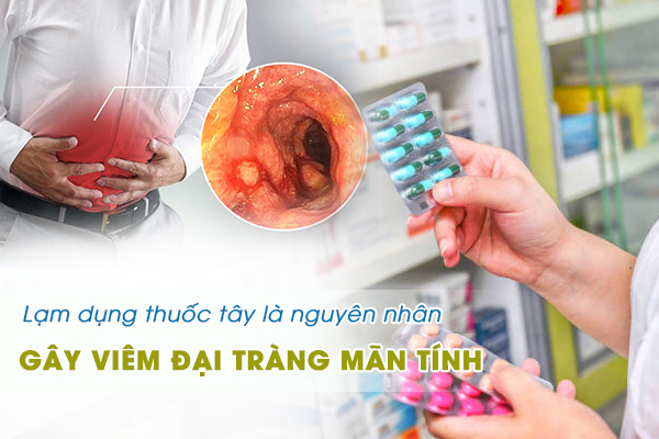 Lạm dụng thuốc tây là nguyên nhân thường gặp gây viêm đại tràng mãn tính