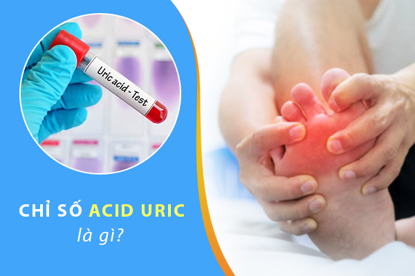 Chỉ số acid uric là gì? Các nguyên nhân gây tăng chỉ số acid uric máu