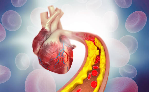 Quả dâu tây giúp giảm cholesterol máu, tốt cho sức khỏe tim mạch