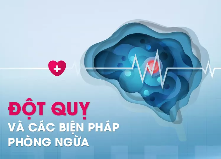 Cách phòng ngừa đột quỵ: Bạn đã biết?