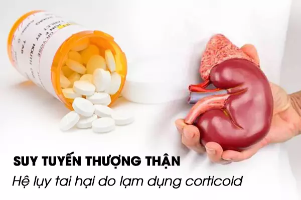 Suy tuyến thượng thận - Hệ lụy tai hại do lạm dụng corticoid