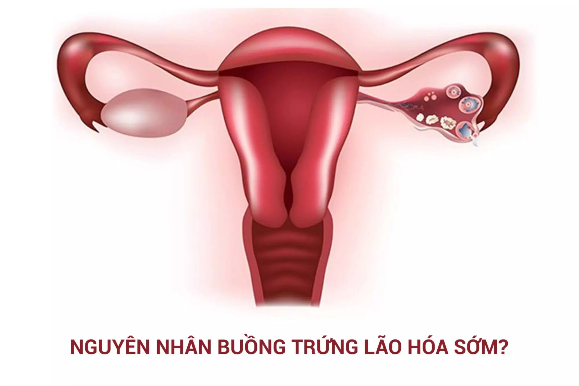 Nguyên nhân buồng trứng lão hóa sớm và cách cải thiện