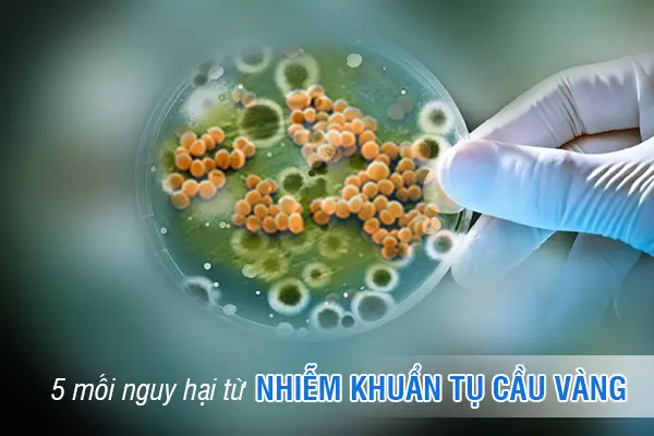 5 mối nguy hại từ nhiễm khuẩn tụ cầu vàng và cách phòng ngừa mới nhất 2023