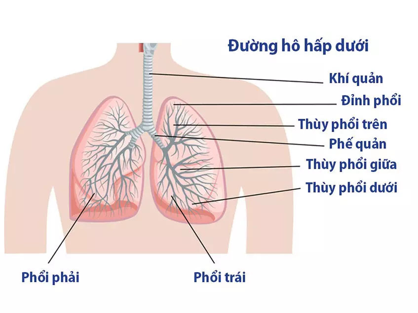 nguyên nhân gây viêm đường hô hấp dưới