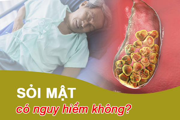 Sỏi mật có nguy hiểm không? Cần làm gì để cải thiện bệnh?