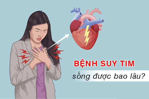 Mắc bệnh suy tim sống được bao lâu?