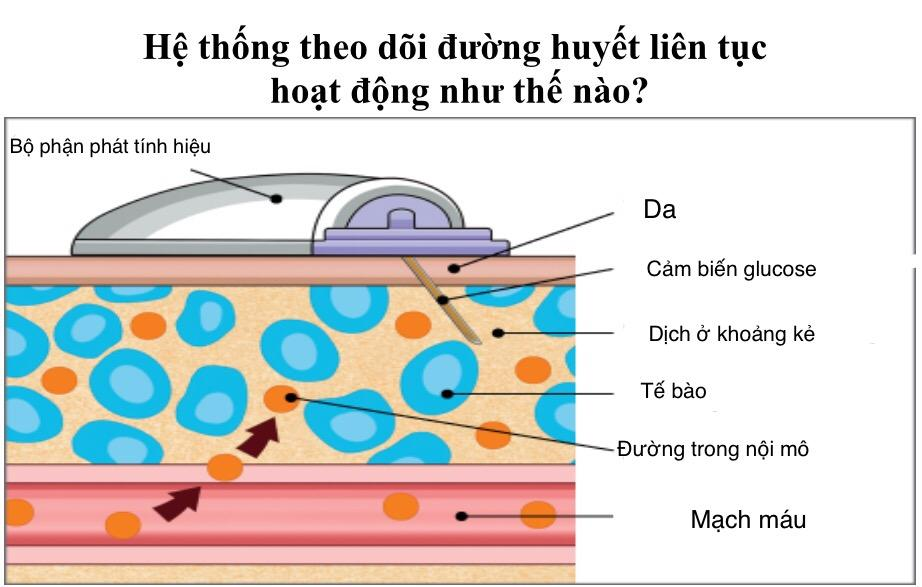 Minh họa cơ chế hoạt động của thiết bị.