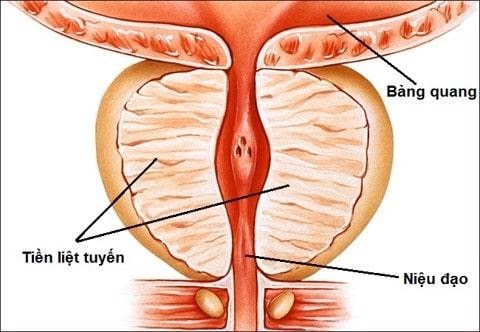 Phương pháp mới loại bỏ ung thư tuyến tiền liệt chỉ trong 1 giờ