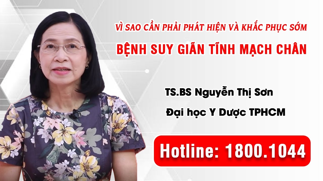 BoniVein - Vì sao cần phải phát hiện và khắc phục sớm bệnh suy giãn tĩnh mạch chân