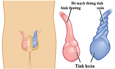 xoắn tinh hoàn ở nam giới