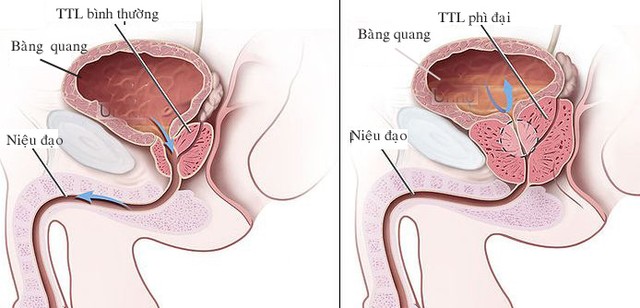 Hỏi: Thắc mắc về hiệu quả của BoniMen