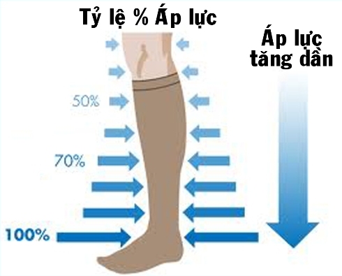 Thận trọng khi dùng tất áp lực chữa giãn tĩnh mạch chân